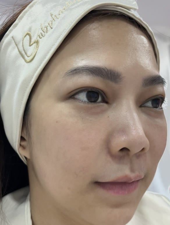 ใบหน้าก่อนการดูแลผิวหน้า (ตัวอย่างจากคลินิก)